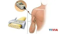 d81281f4cfa1b038c75397fed368ef1c-thumb-standard