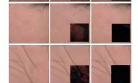 5637a973523bca3664f0b90181357c73-thumb-medium