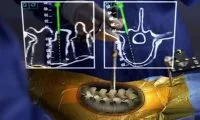 97d5cd3295e6d6e8235d9757841fefb5-thumb-standard