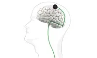 1e87cc832e4da7bbb72182ba00c16c49-thumb-standard