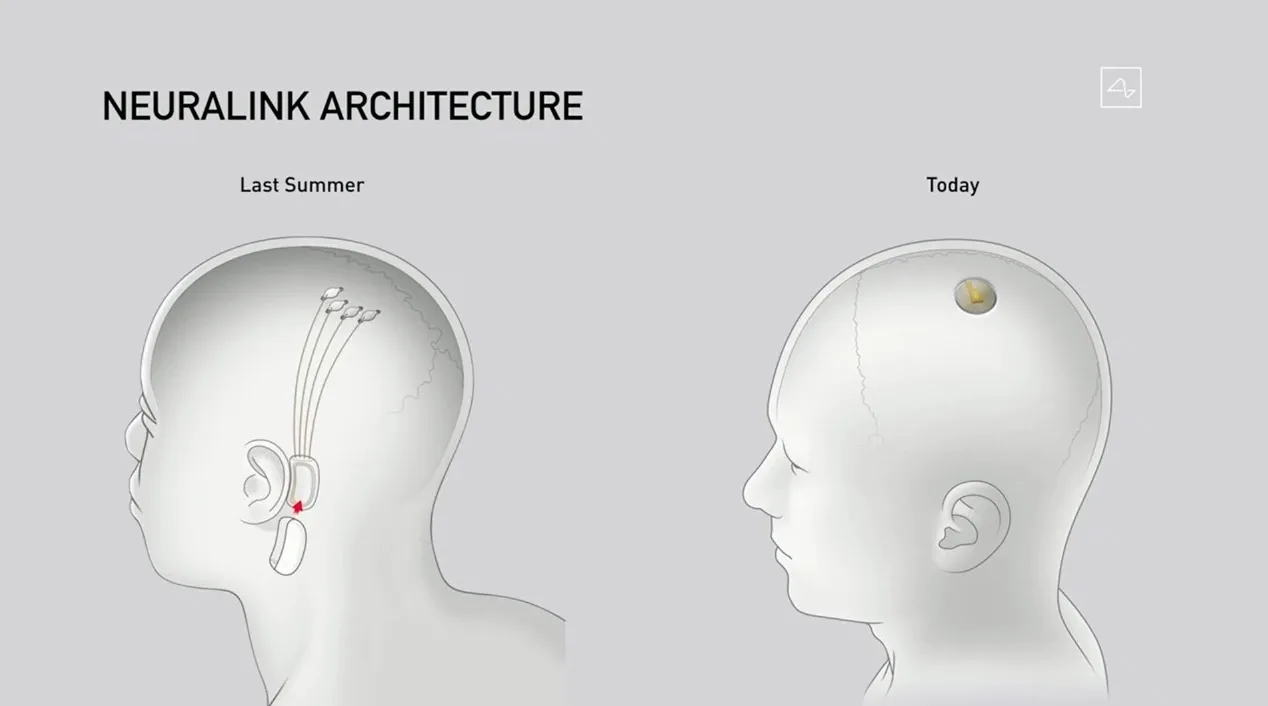 马斯克用三头猪演示Neuralink最新脑机接口技术