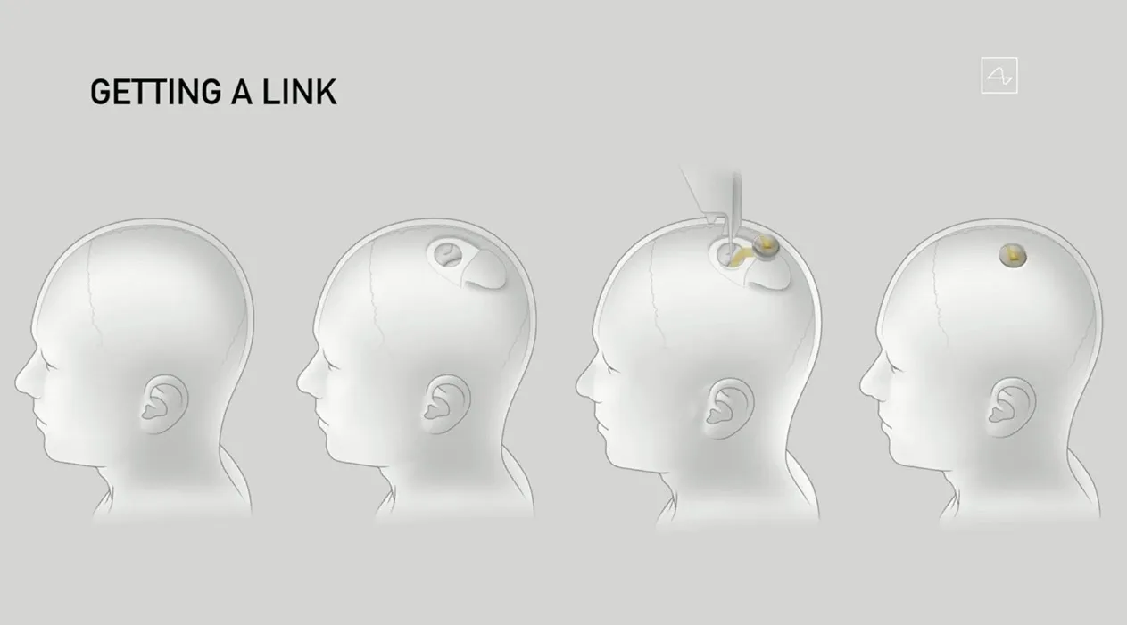 马斯克用三头猪演示Neuralink最新脑机接口技术