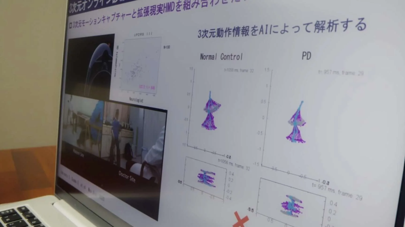 日本顺天堂大学用HoloLens 2开发双向3D在线诊疗系统Holomedicine