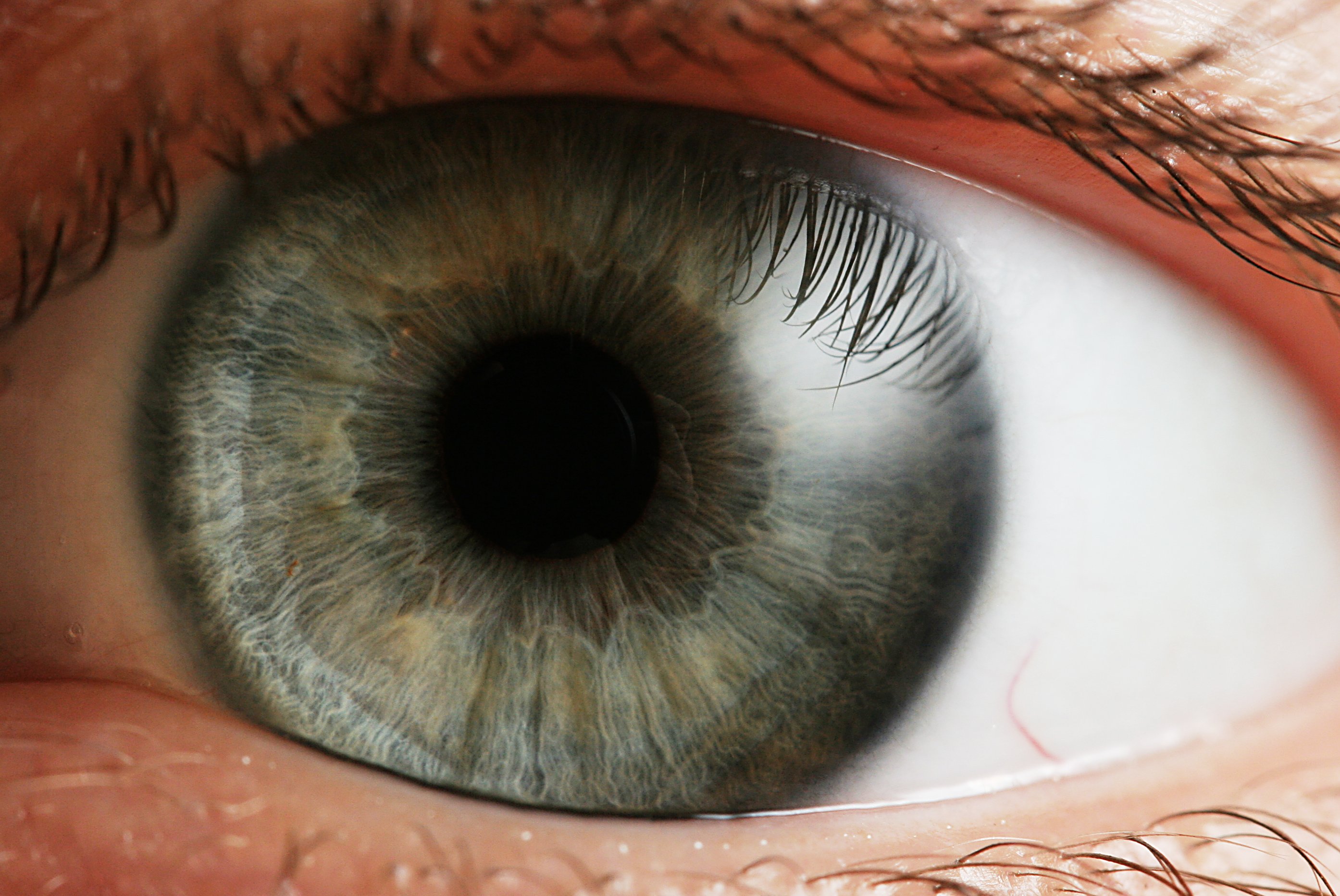 Eye_iris-thumb-standard