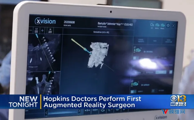 Hopkins-Doctors-Perform-First-Augmented-Reality-Surgery.mp4_20200612_090057.764